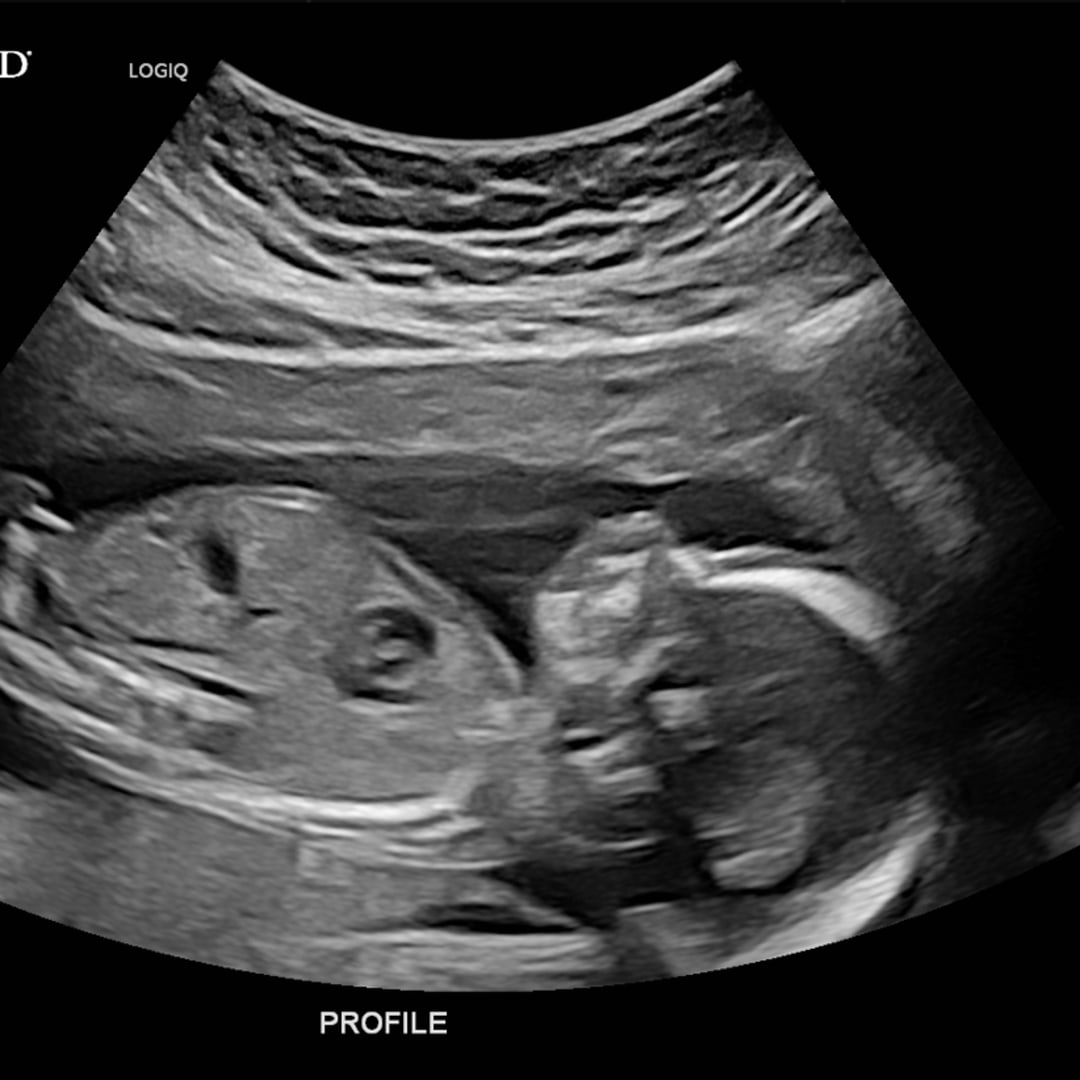 Photo shared by Kate for their Babylist baby registry.