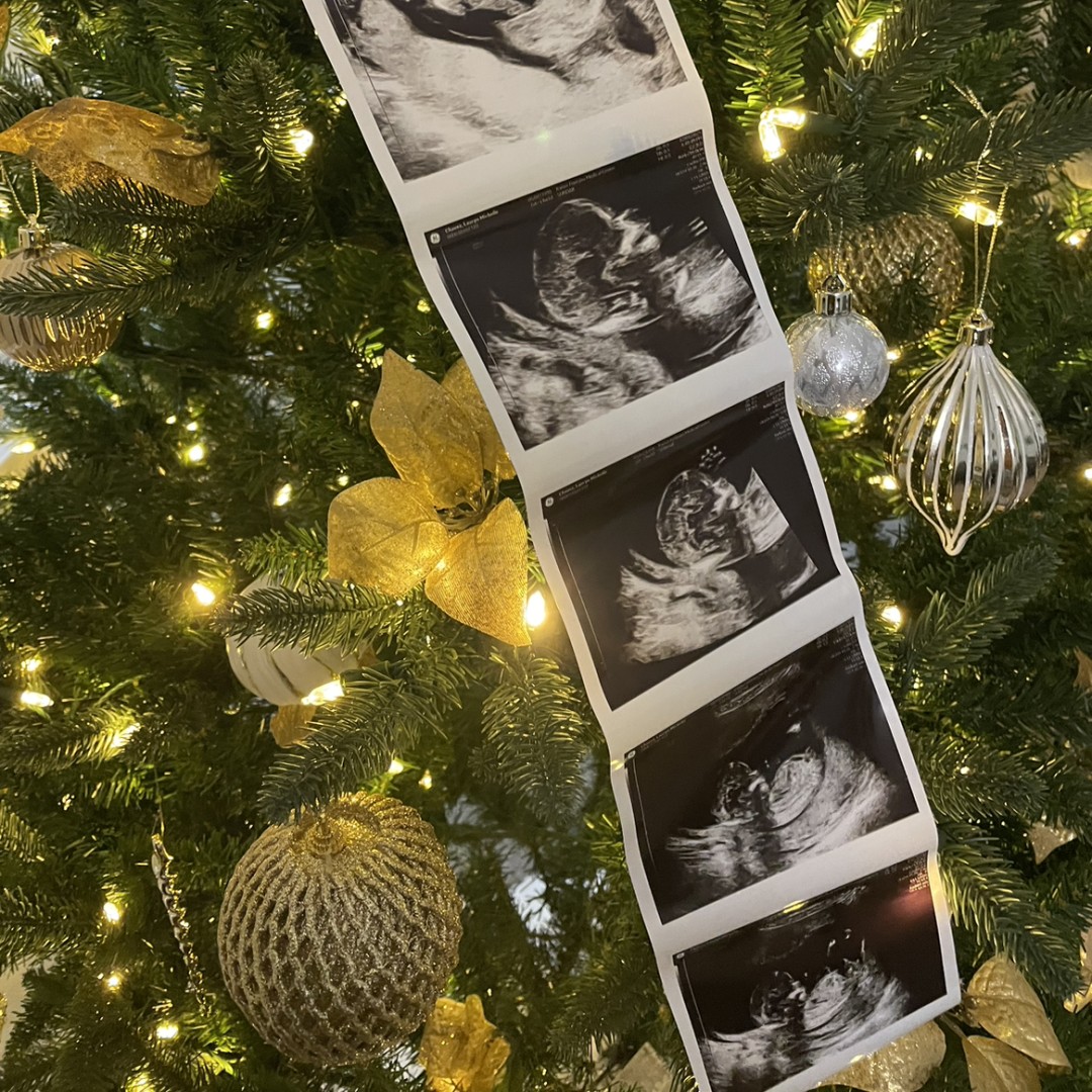 Photo shared by Lauryn for their Babylist baby registry.