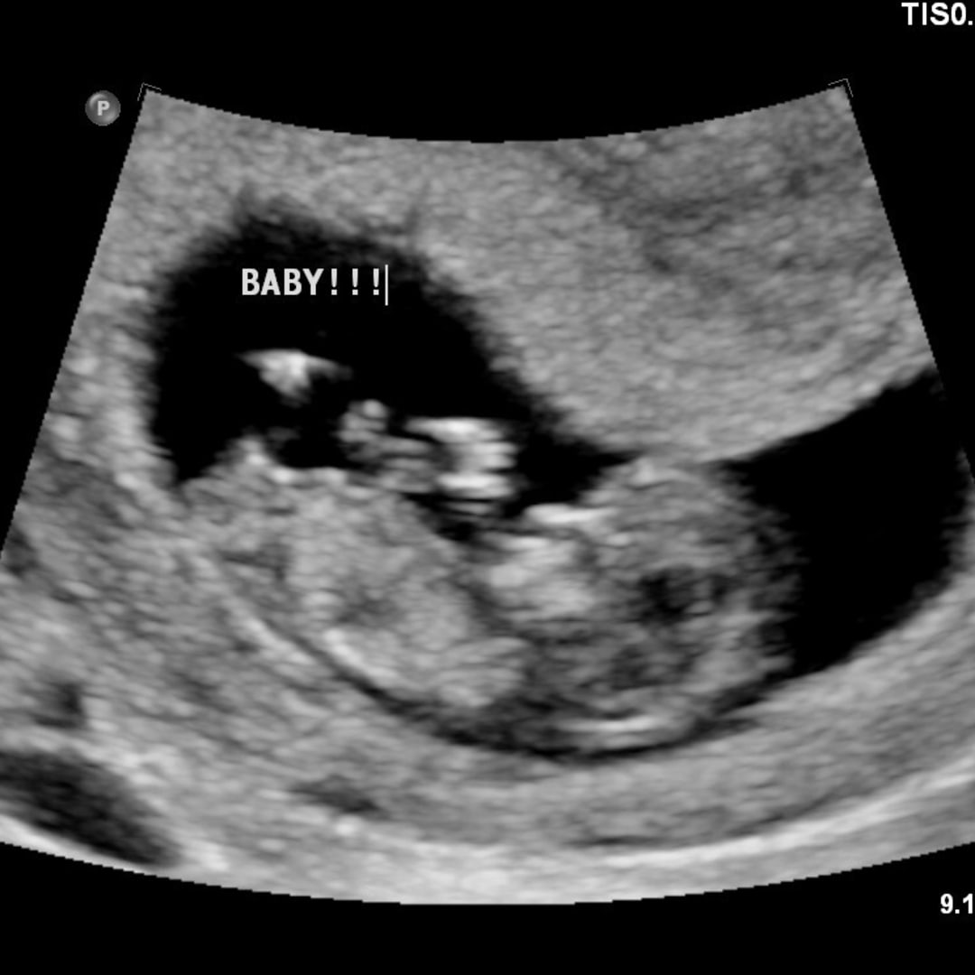 Photo shared by Gracie for their Babylist baby registry.