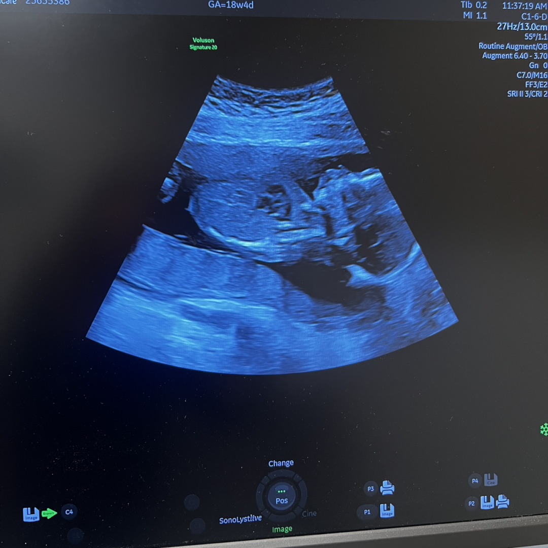 Photo shared by Viridiana for their Babylist baby registry.