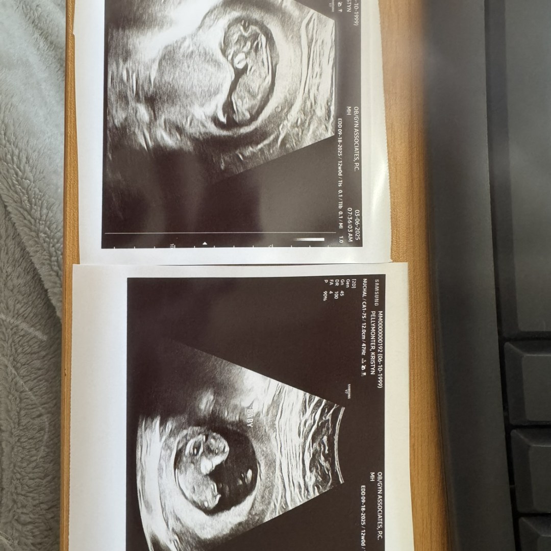 Photo shared by Kristyn for their Babylist baby registry.