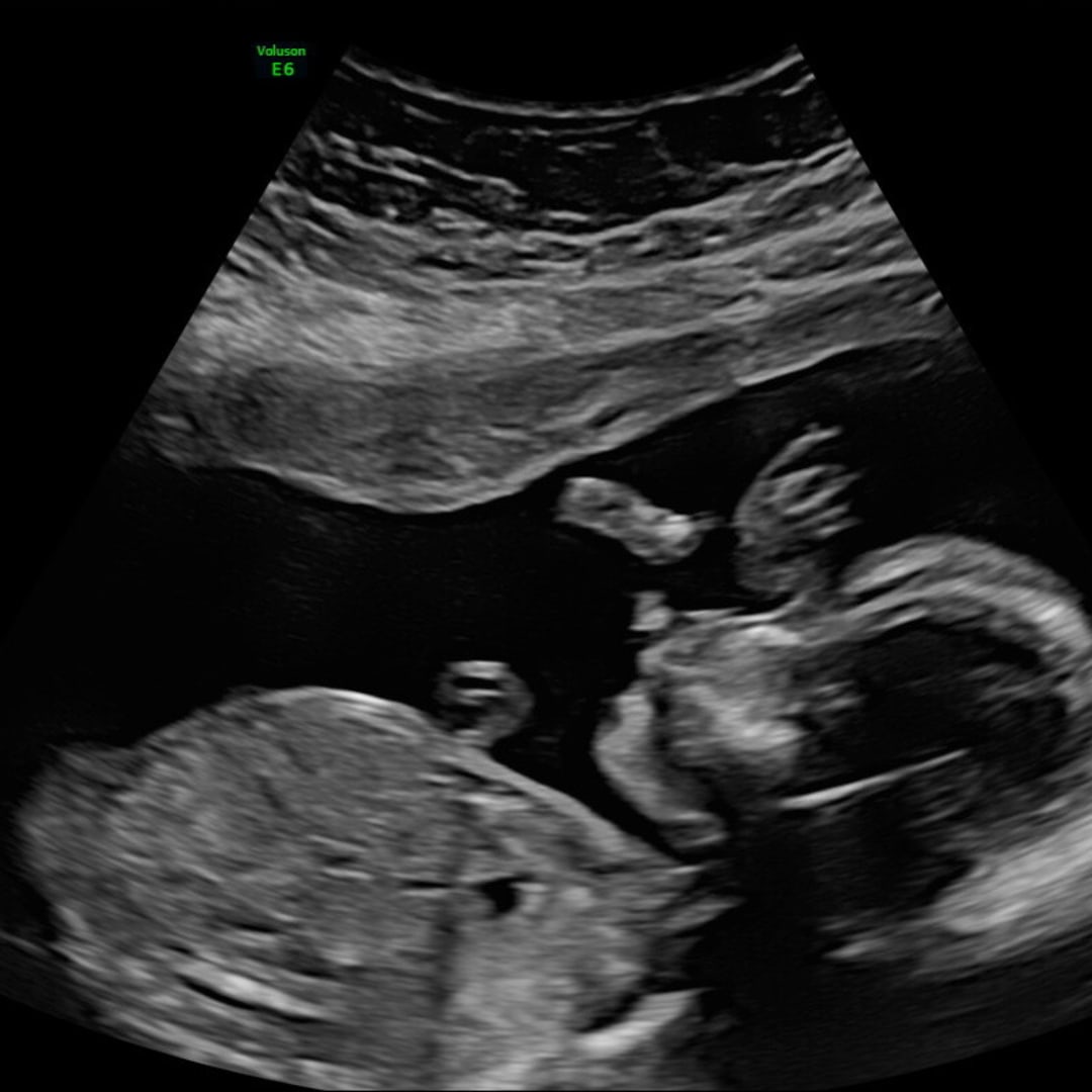 Photo shared by Christa for their Babylist baby registry.