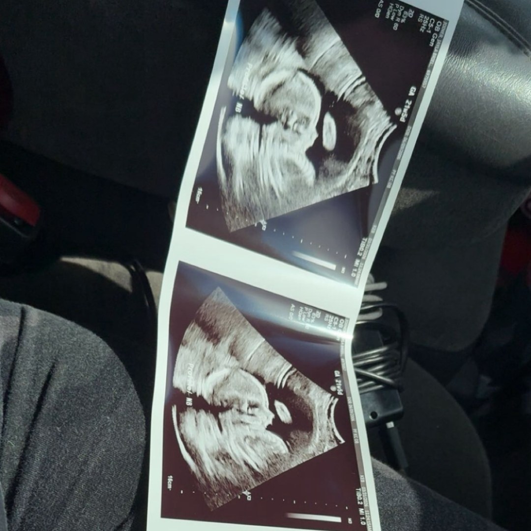 Photo shared by Jayla for their Babylist baby registry.