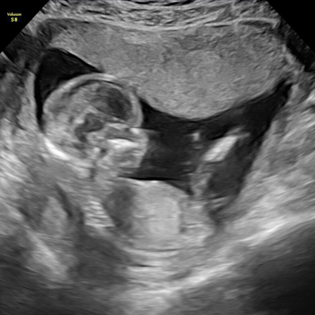 Photo shared by Jaide for their Babylist baby registry.