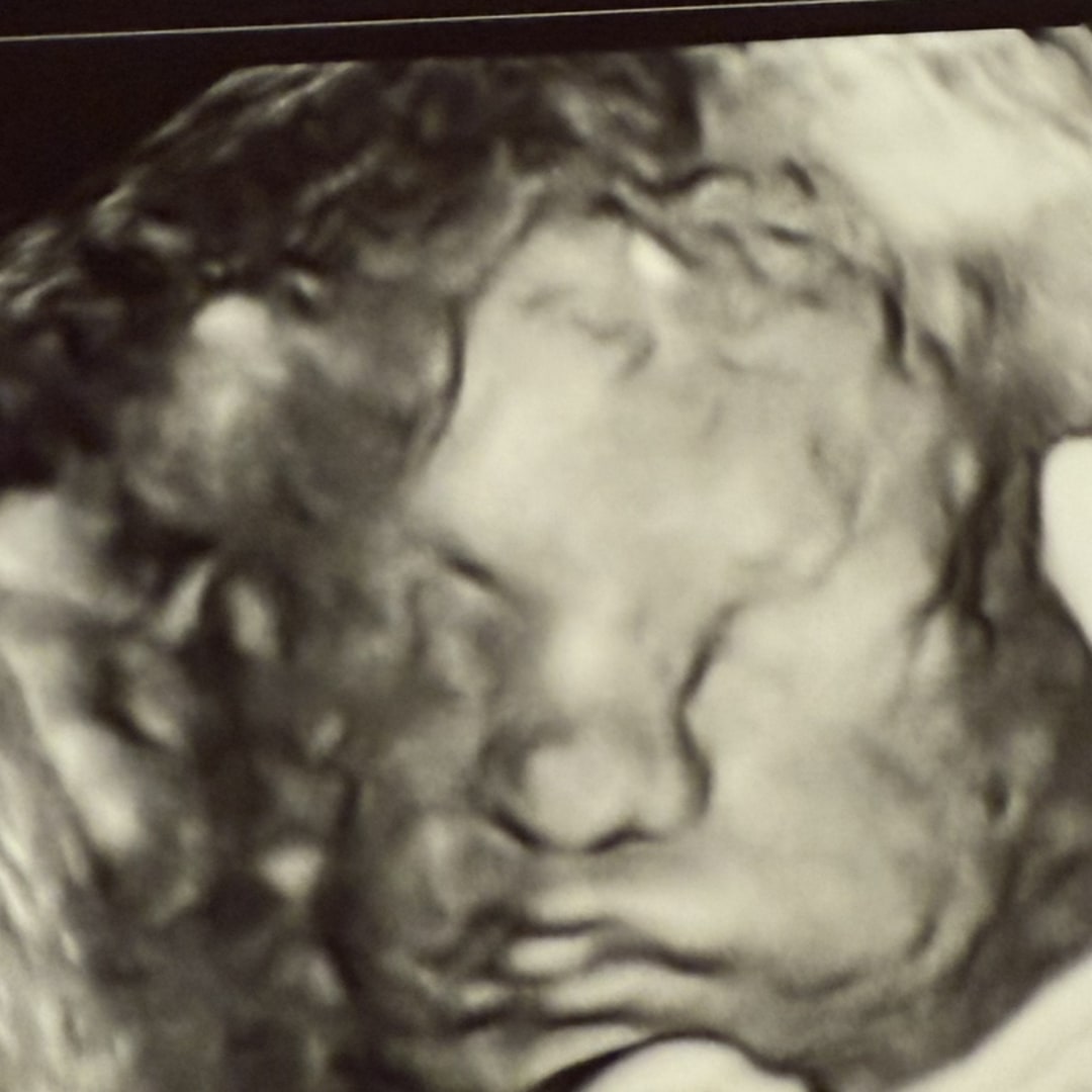 Photo shared by Leslie for their Babylist baby registry.