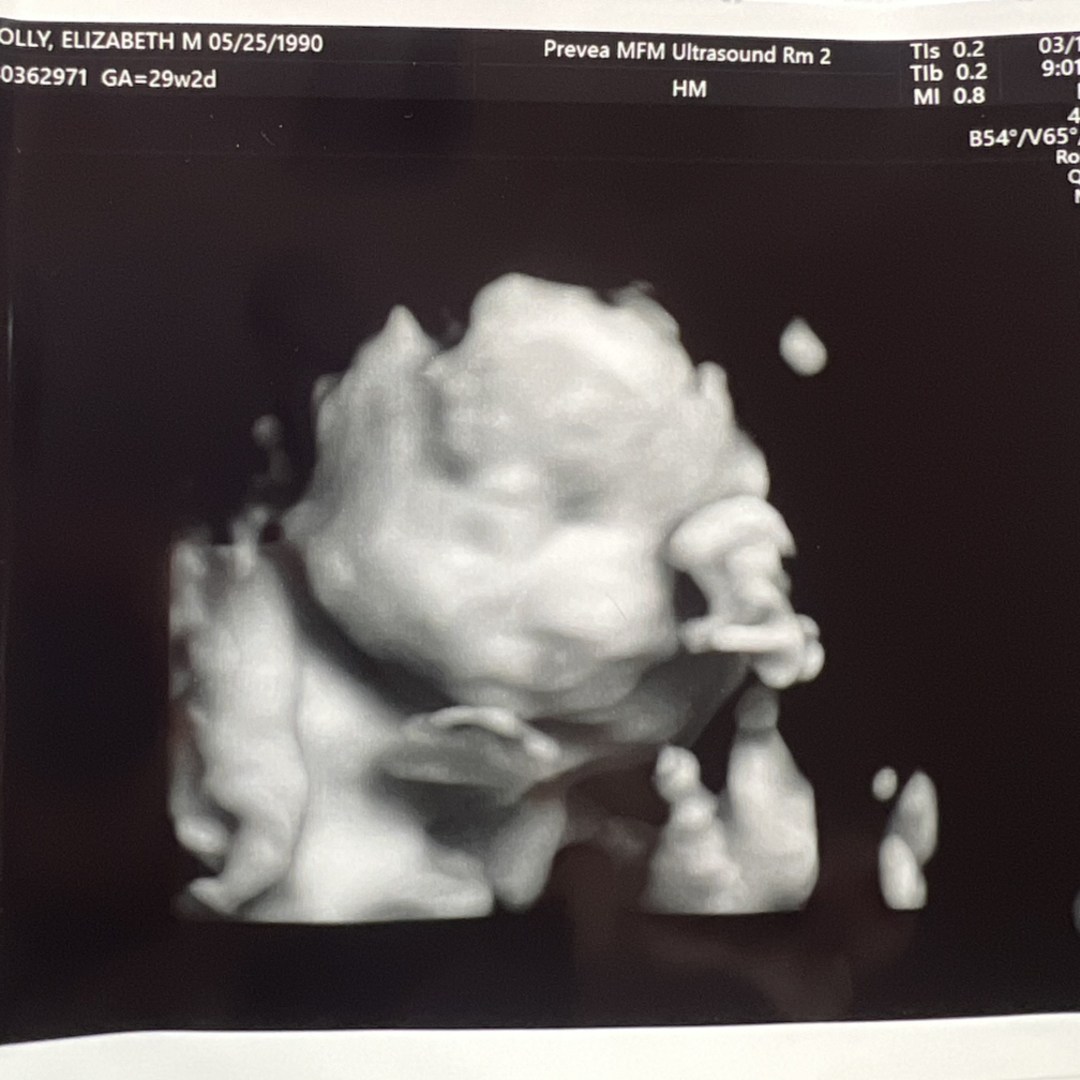 Photo shared by Elizabeth for their Babylist baby registry.