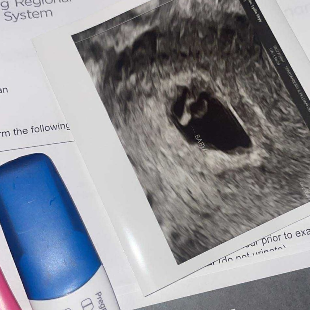 Photo shared by Lydia for their Babylist baby registry.