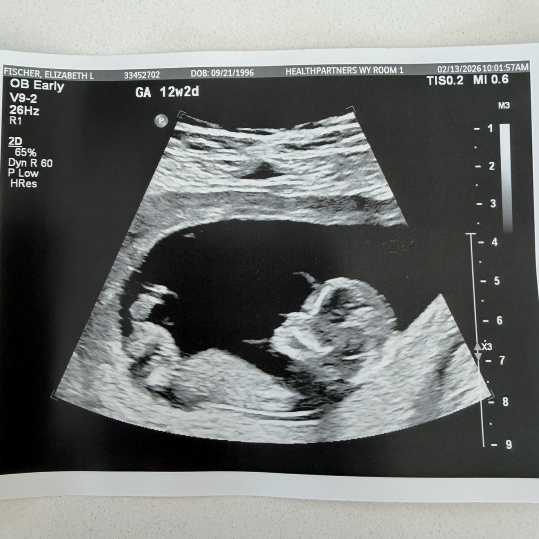 Photo shared by Elizabeth for their Babylist baby registry.