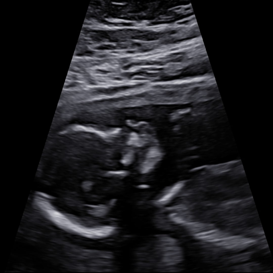 Photo shared by Paige for their Babylist baby registry.