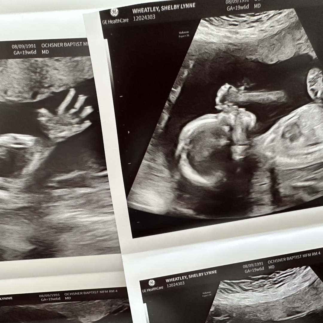 Photo shared by Shelby for their Babylist baby registry.