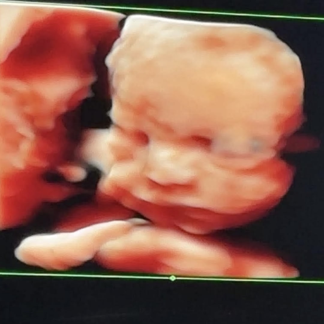 Photo shared by Ashlee for their Babylist baby registry.