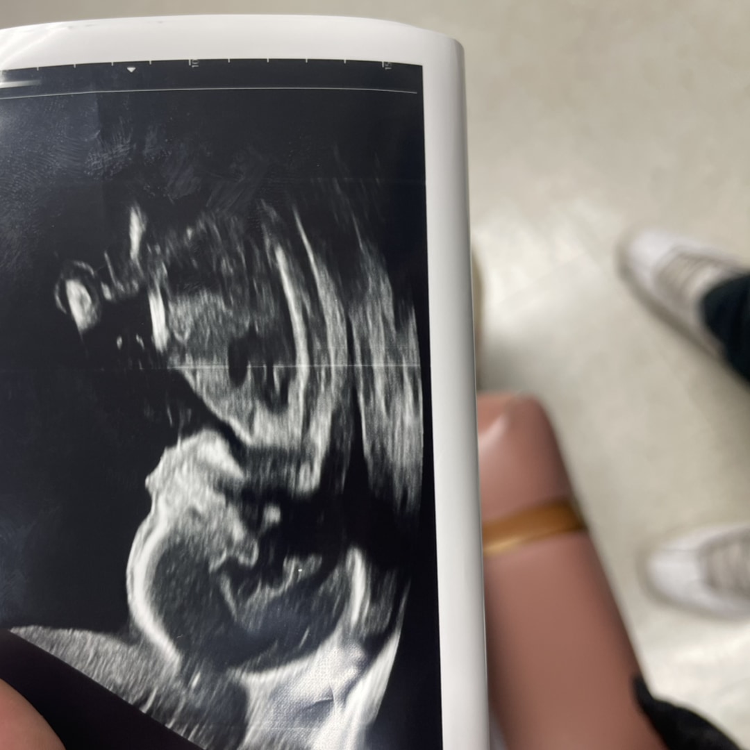 Photo shared by Dionis for their Babylist baby registry.