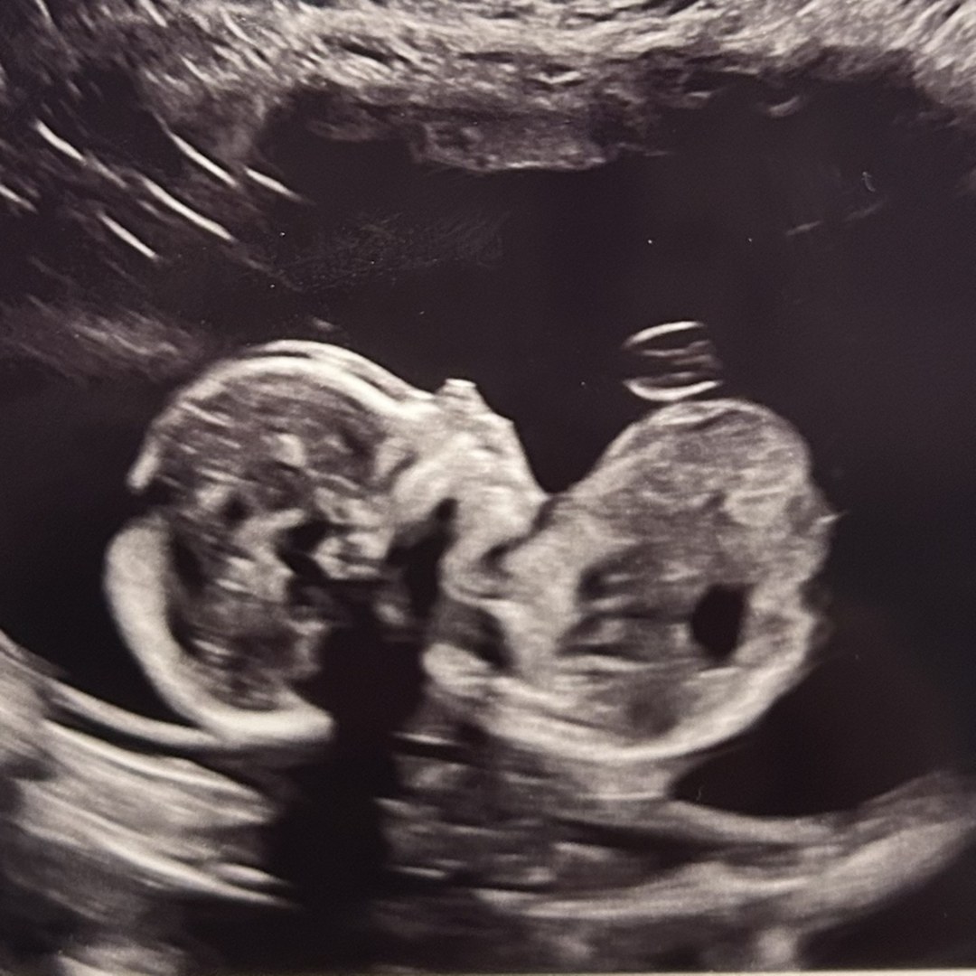 Photo shared by Courtney for their Babylist baby registry.