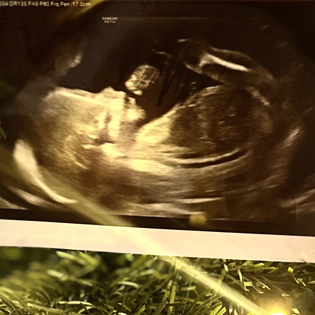 Photo shared by Evelyn for their Babylist baby registry.