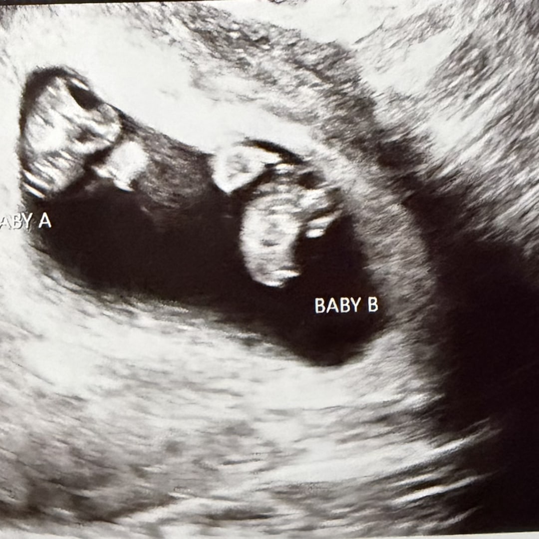 Photo shared by Franny for their Babylist baby registry.