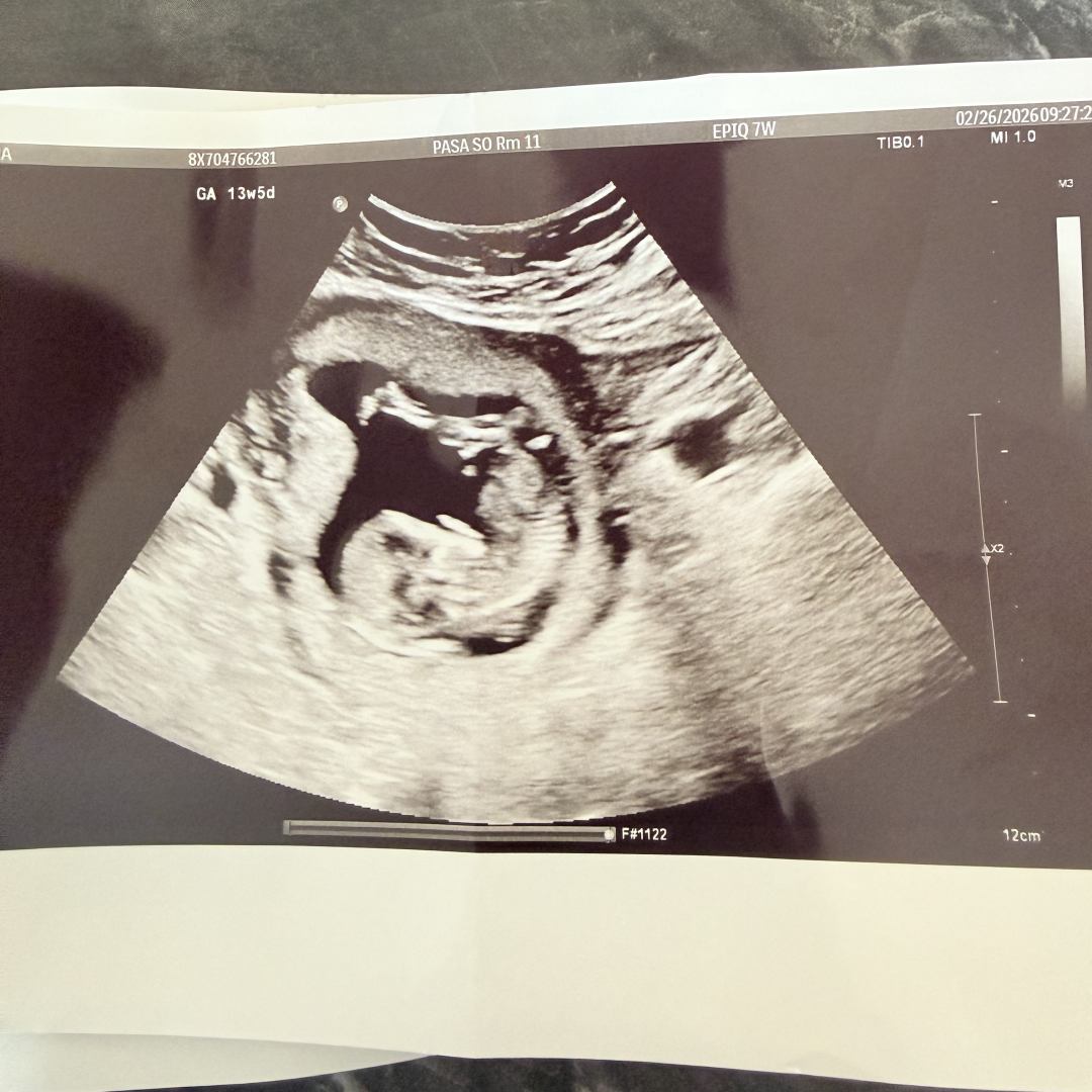 Photo shared by Norma for their Babylist baby registry.