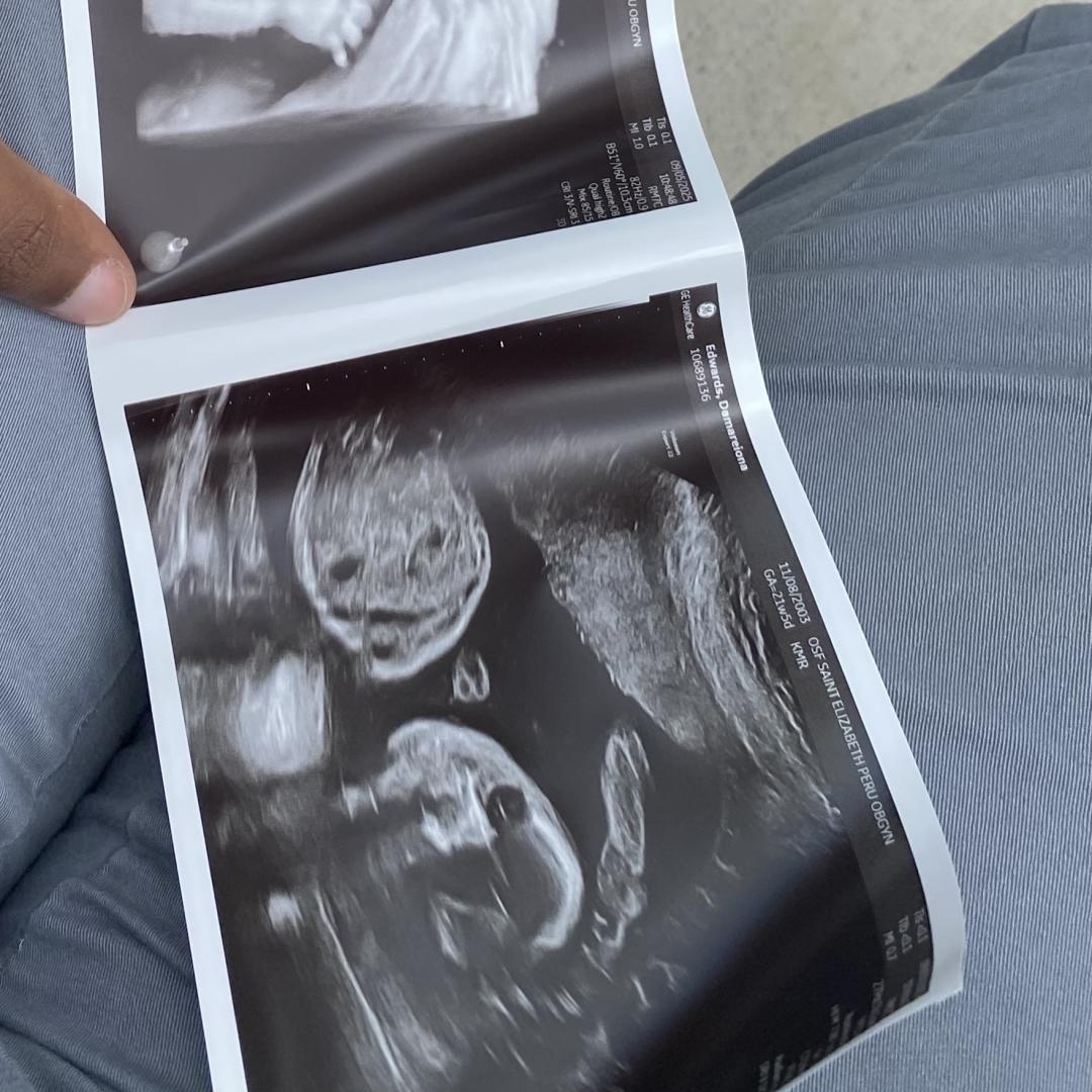 Photo shared by Damareiona for their Babylist baby registry.