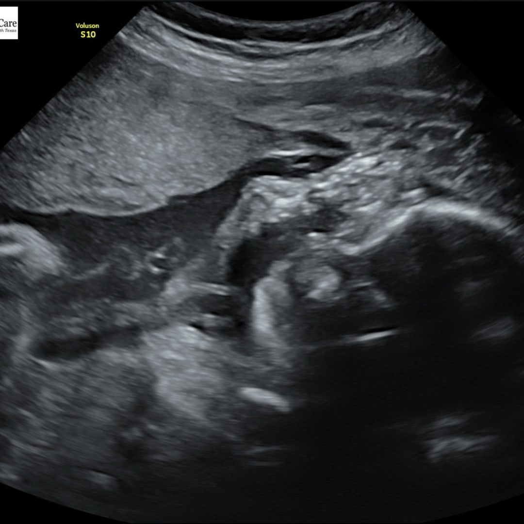 Photo shared by Caylen for their Babylist baby registry.