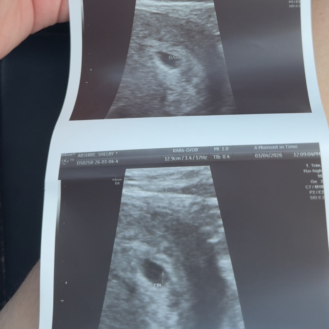 Photo shared by Shelby for their Babylist baby registry.