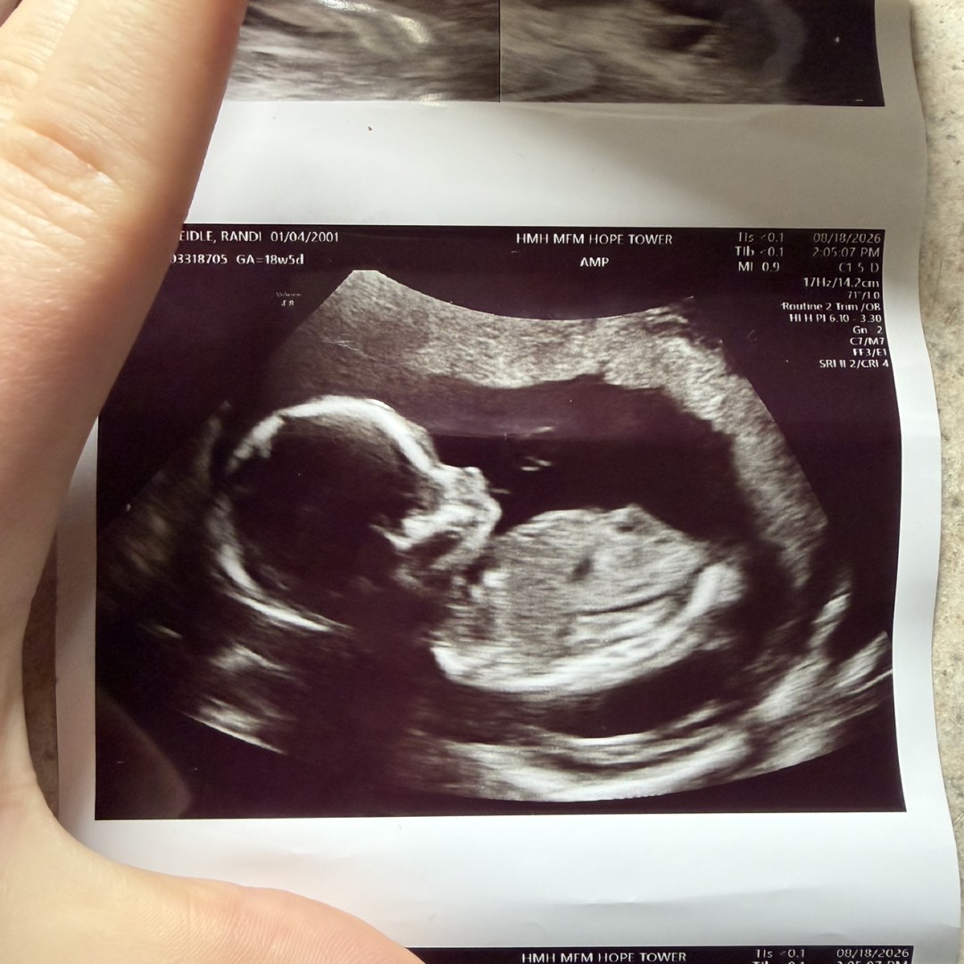 Photo shared by Randi for their Babylist baby registry.