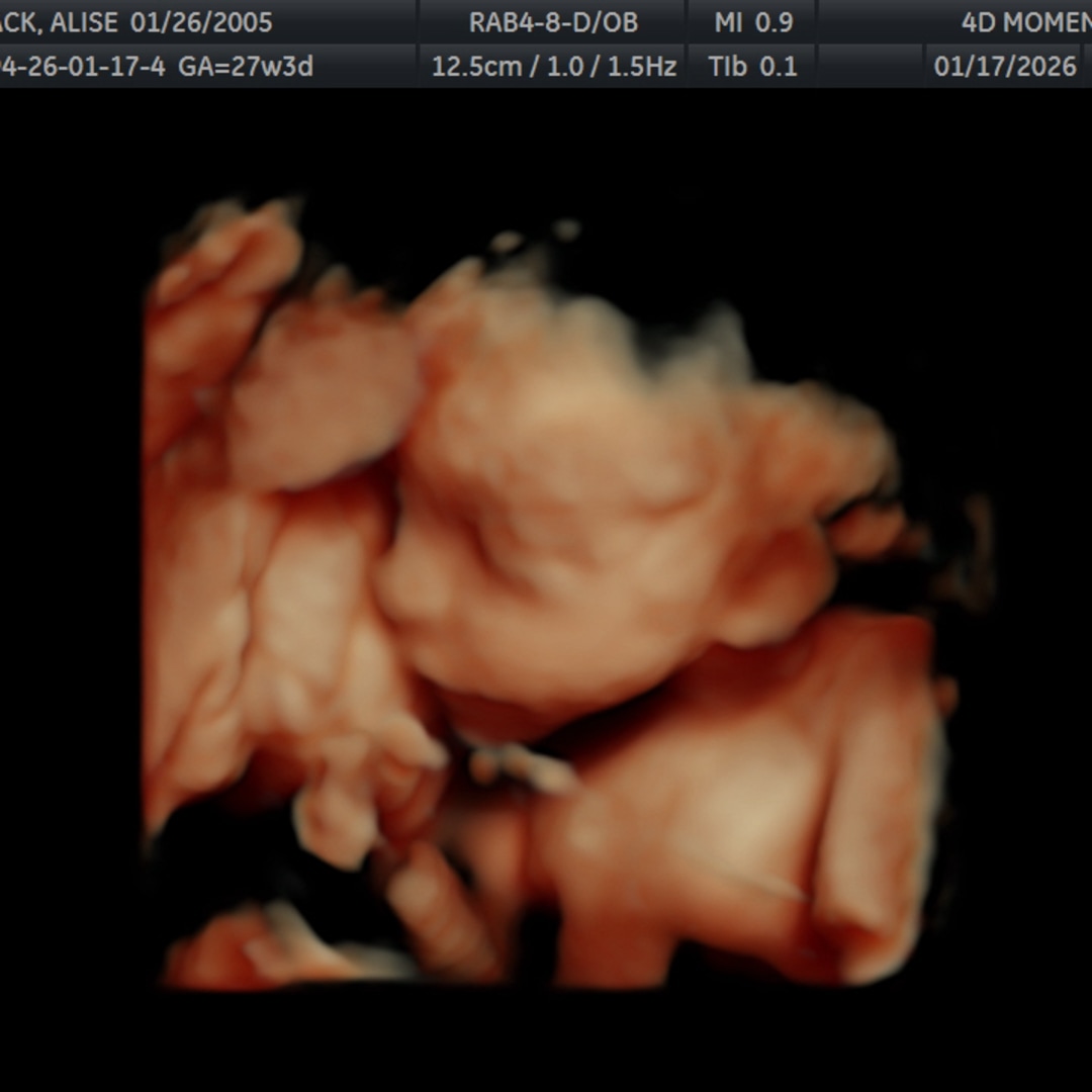 Photo shared by Kole for their Babylist baby registry.