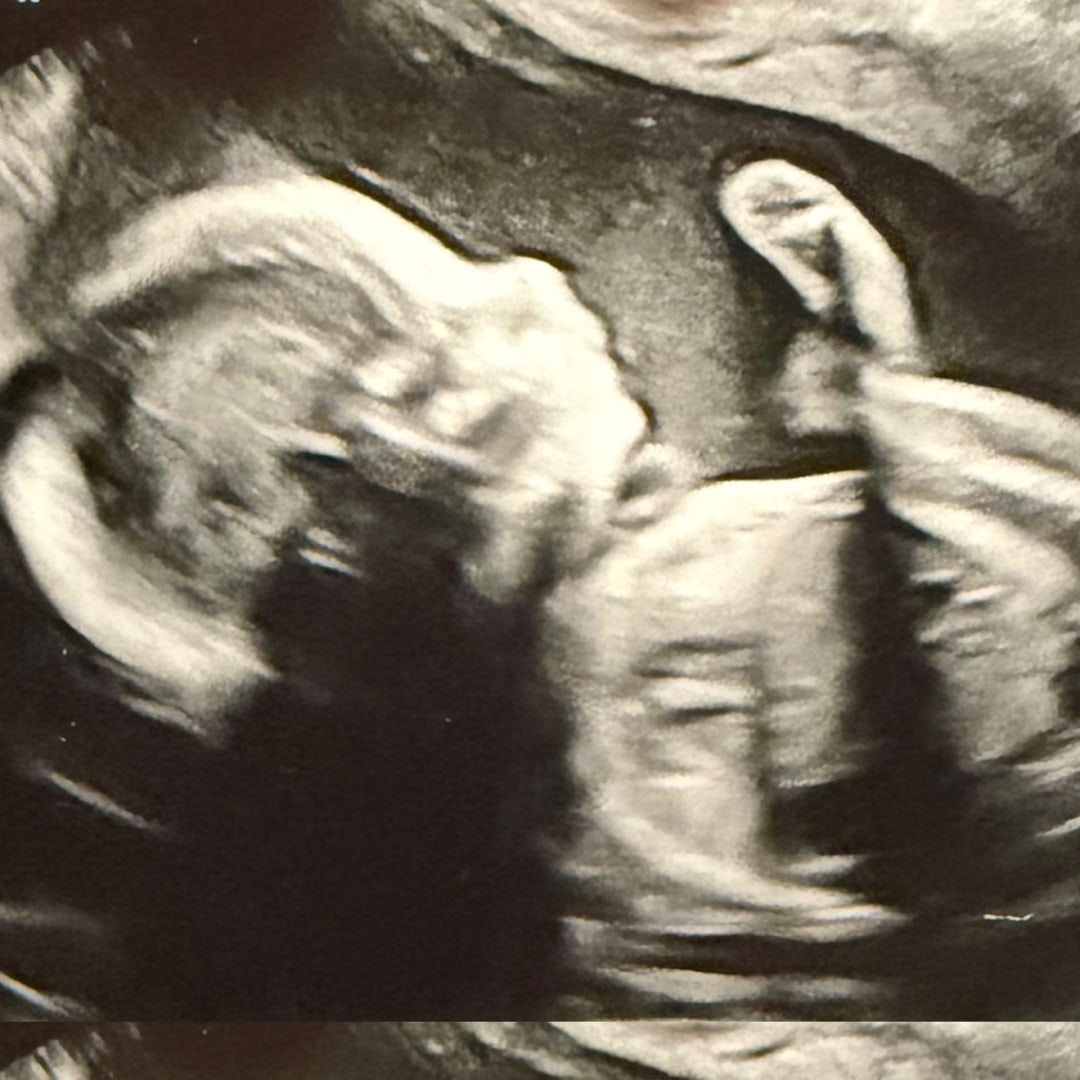 Photo shared by Immerah for their Babylist baby registry.