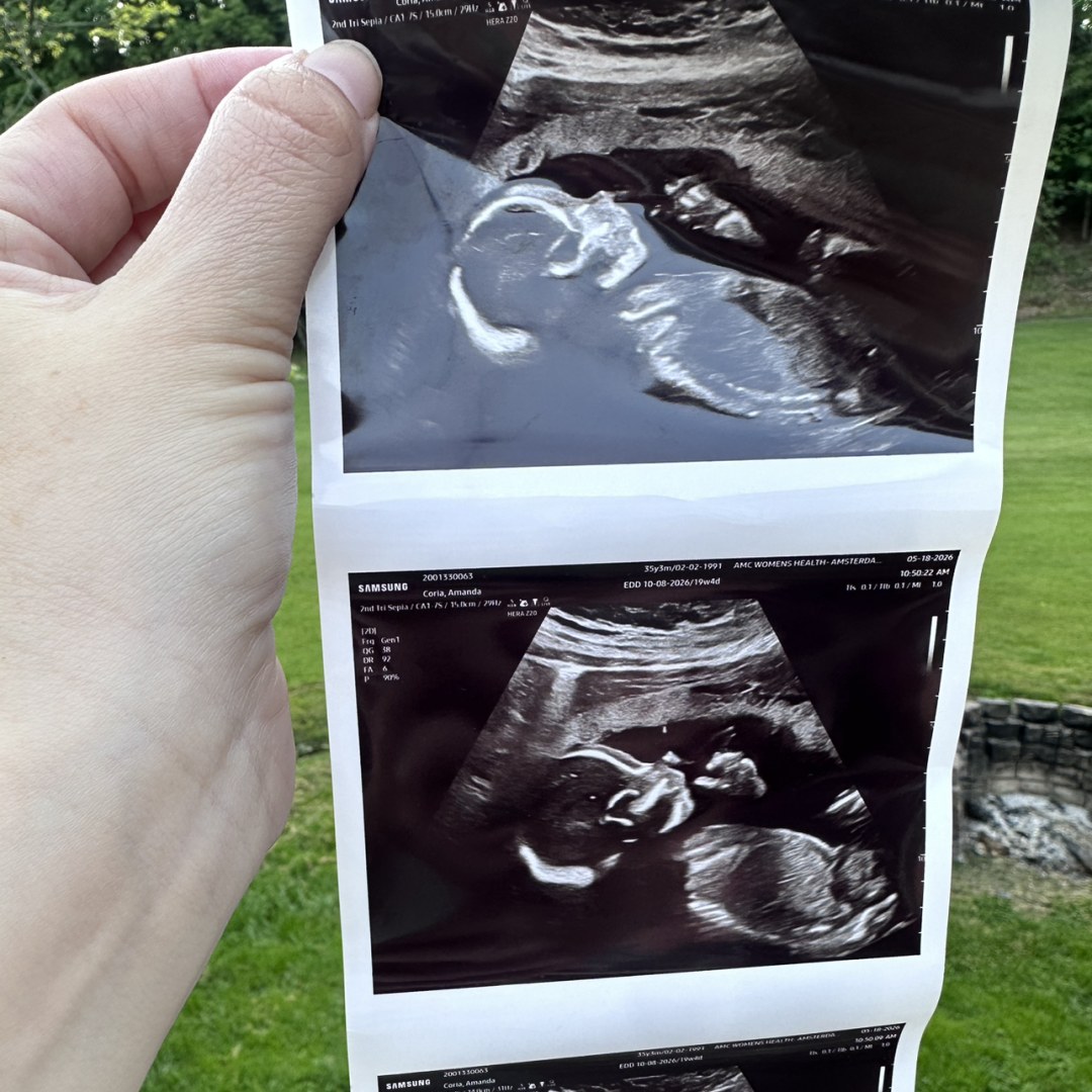 Photo shared by Amanda for their Babylist baby registry.