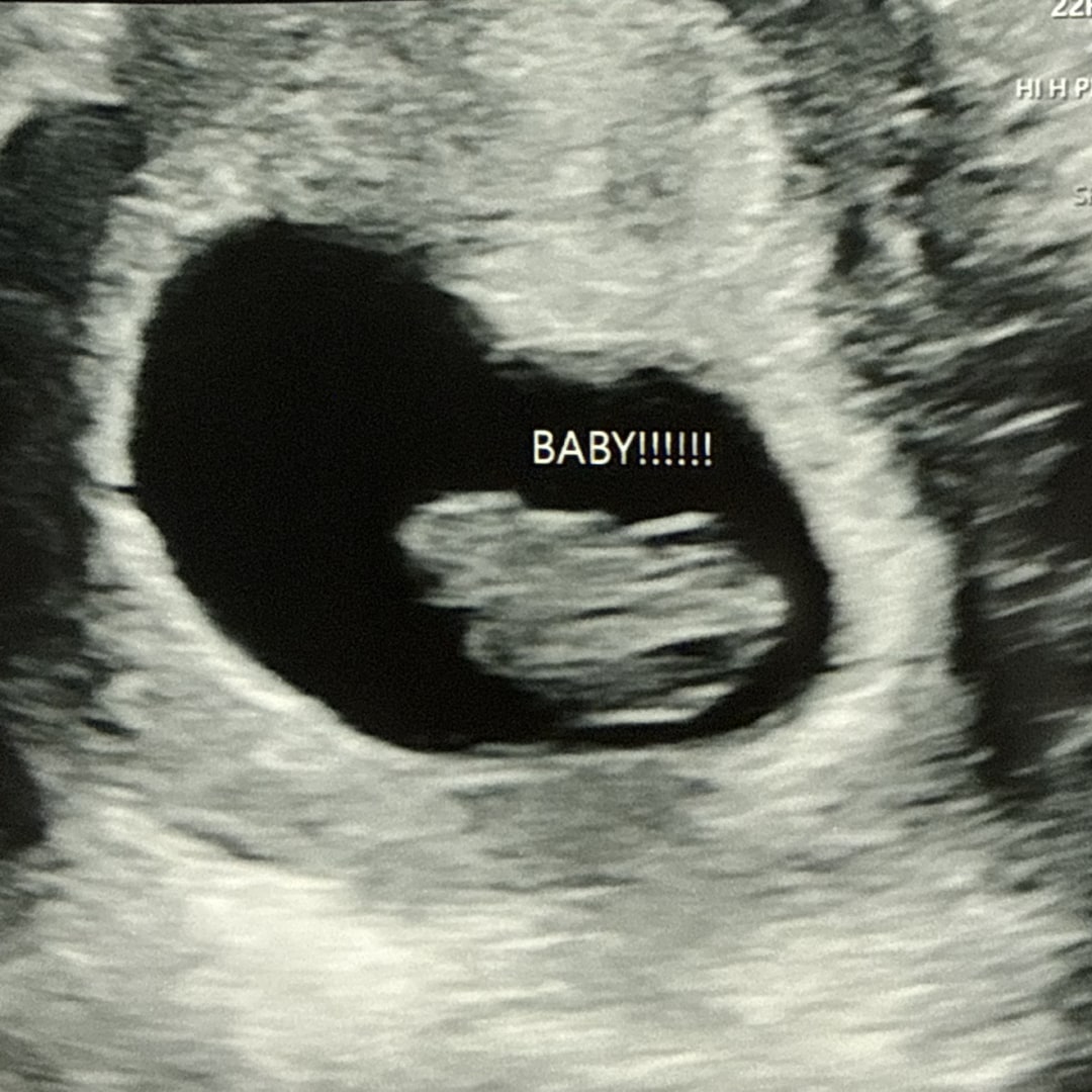 Photo shared by Anna for their Babylist baby registry.