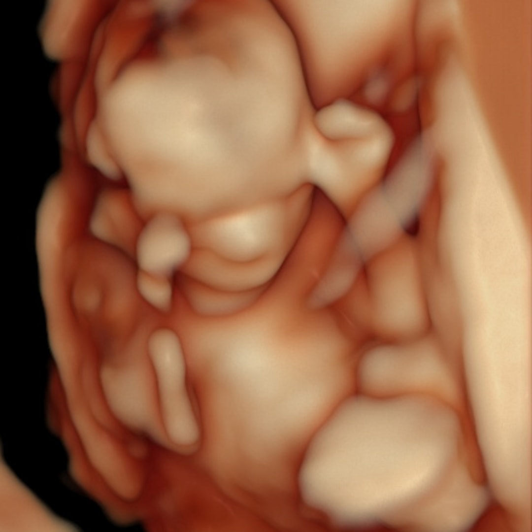 Photo shared by Macey for their Babylist baby registry.