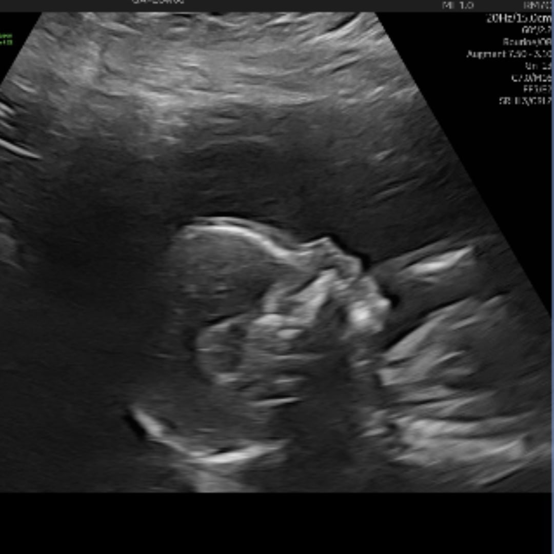 Photo shared by Danielle for their Babylist baby registry.