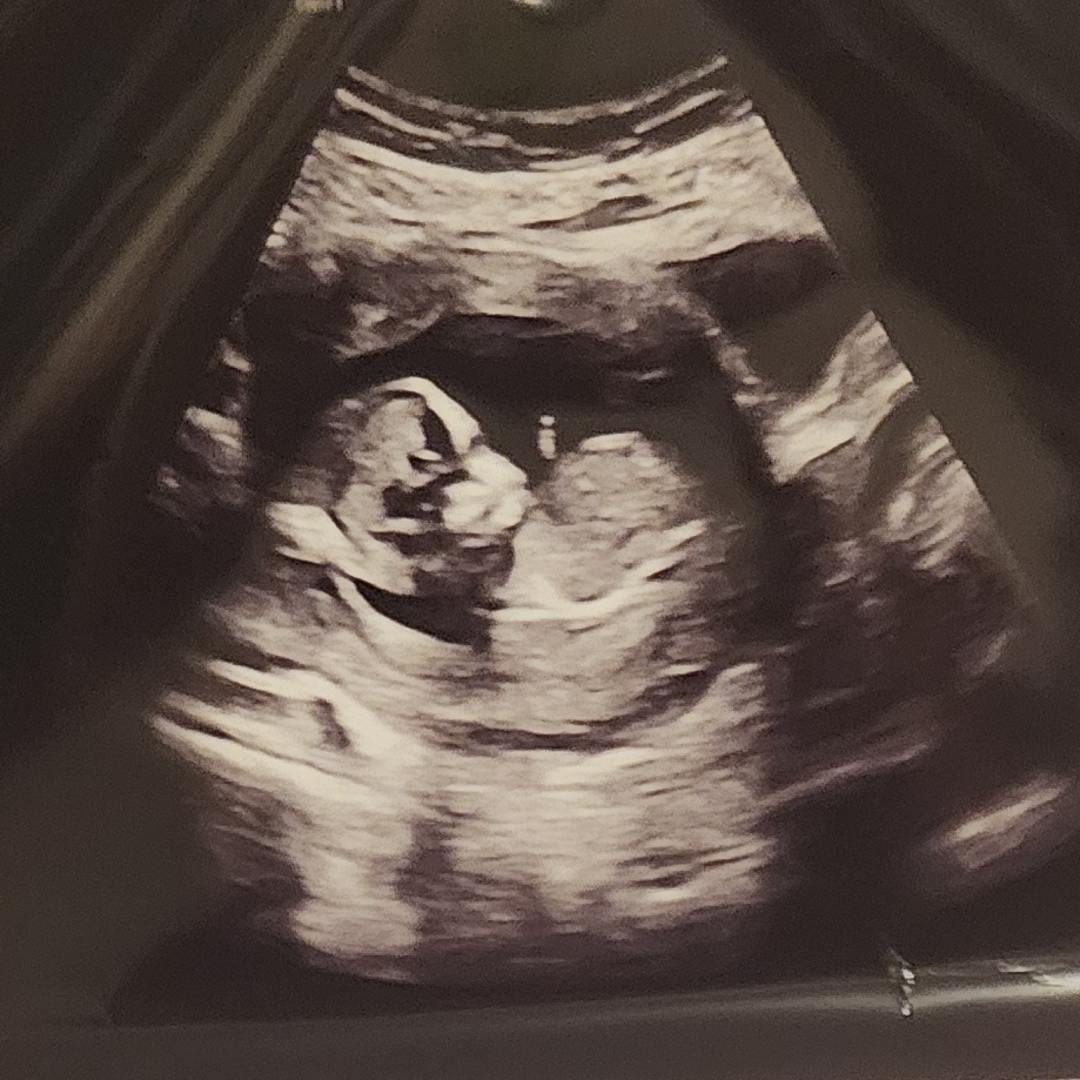 Photo shared by Breanna for their Babylist baby registry.