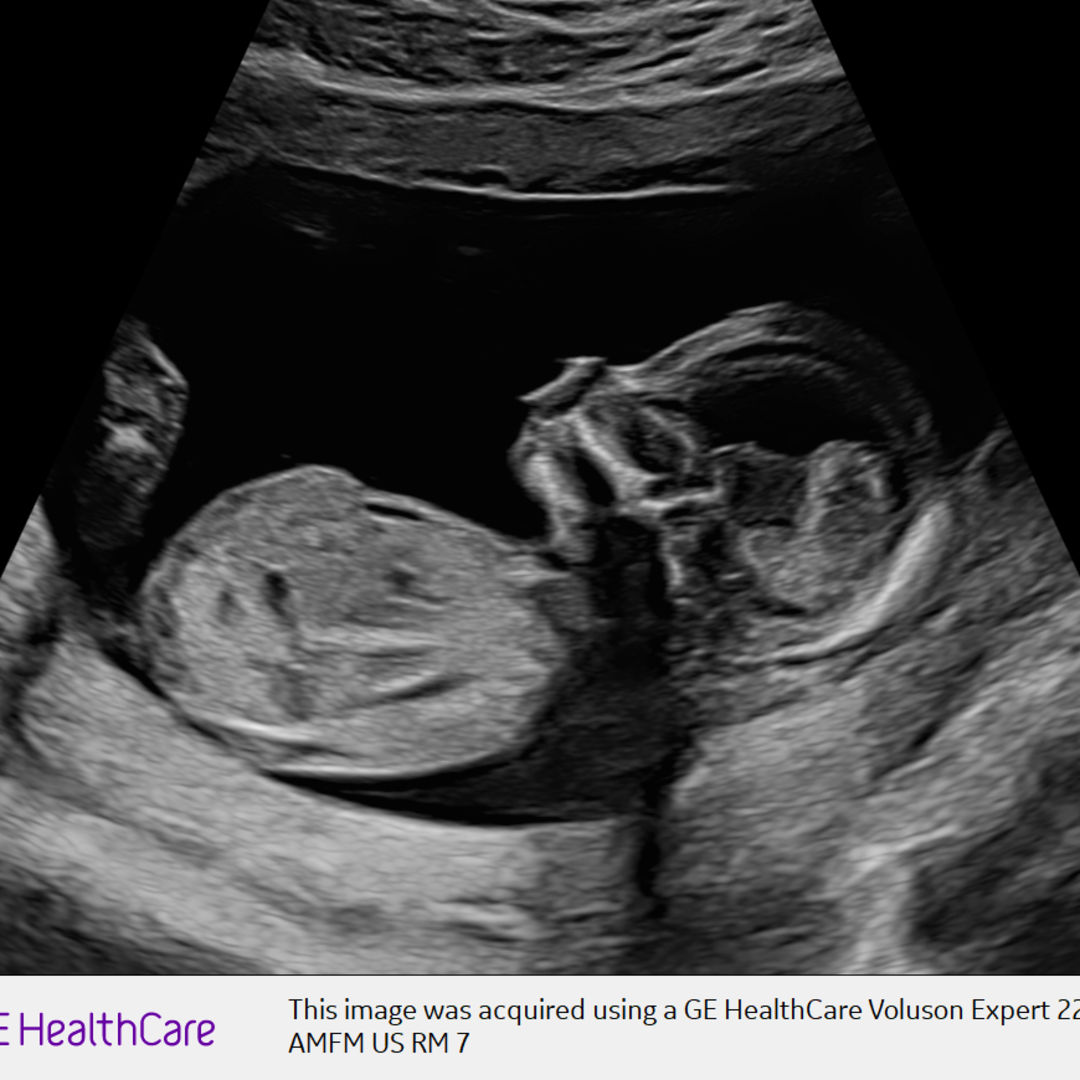 Photo shared by Sarah for their Babylist baby registry.