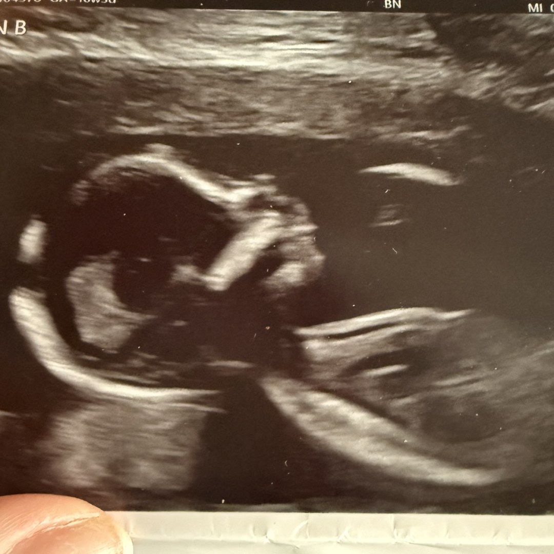 Photo shared by Melissa for their Babylist baby registry.