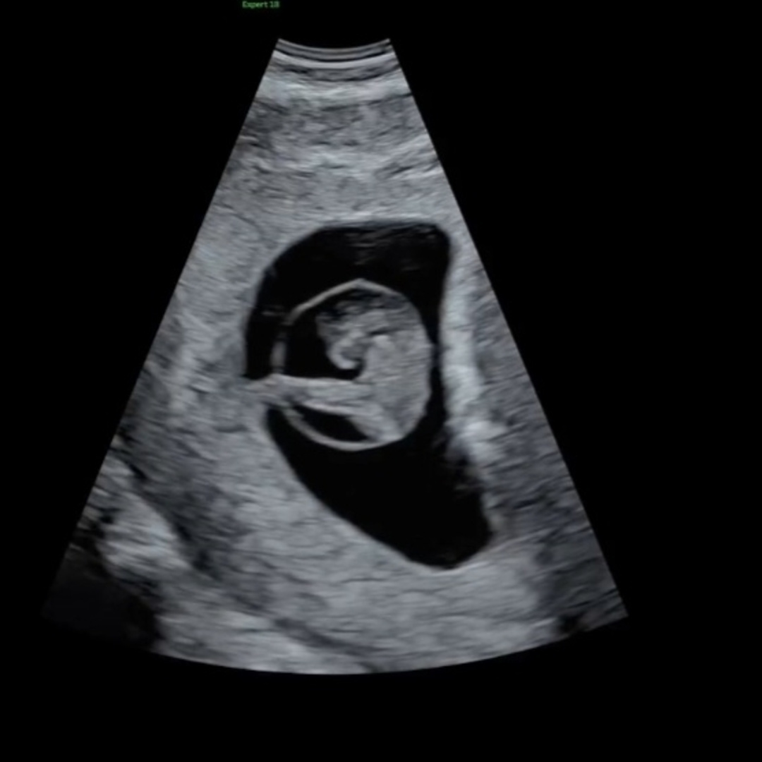 Photo shared by Ariadna Victoria for their Babylist baby registry.