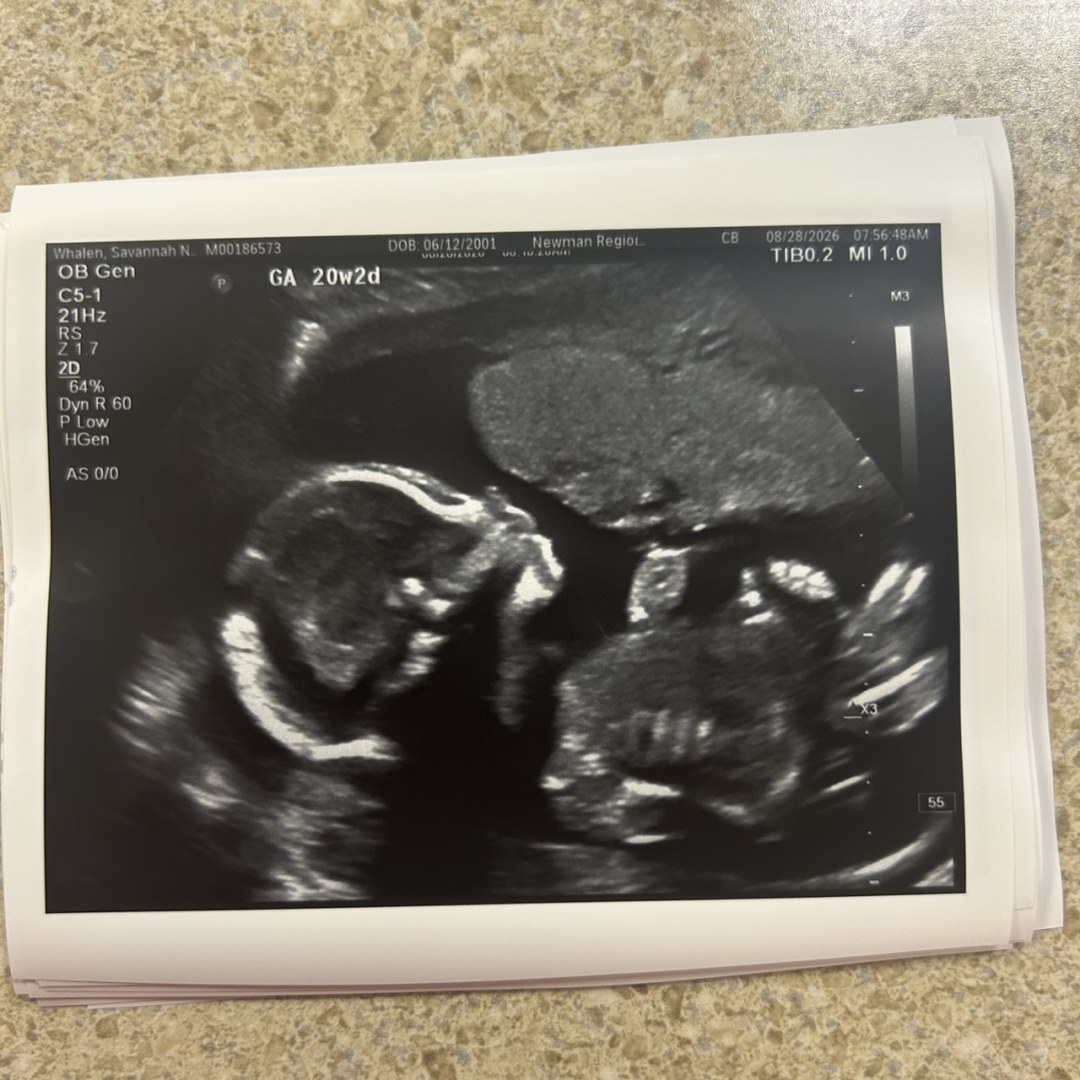 Photo shared by Savannah for their Babylist baby registry.