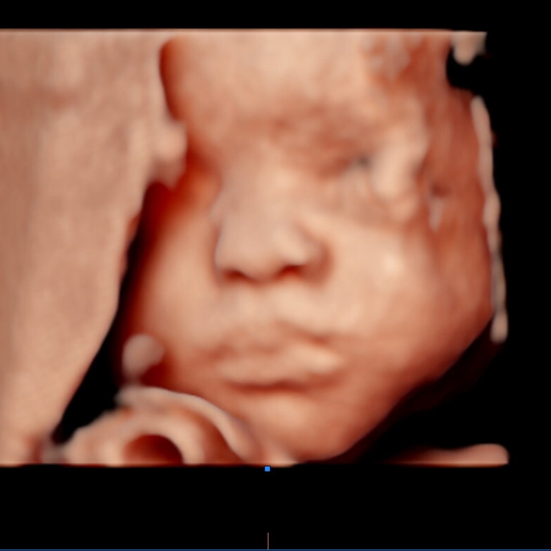 Photo shared by Julissa for their Babylist baby registry.