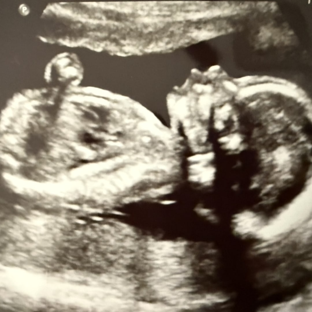 Photo shared by Jessica for their Babylist baby registry.