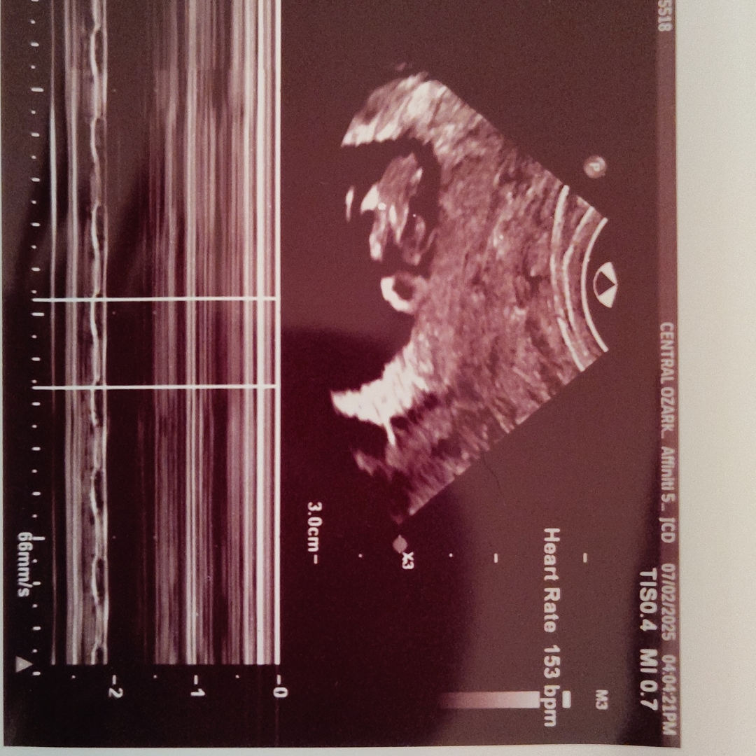 Photo shared by Cheyenne for their Babylist baby registry.