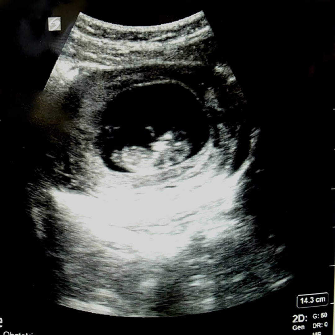 Photo shared by Anthony for their Babylist baby registry.