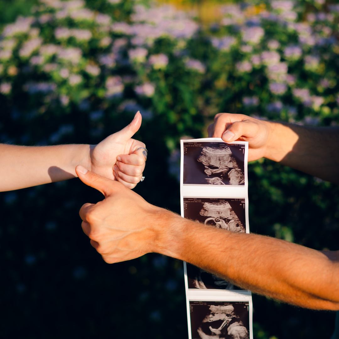 Photo shared by Sierra for their Babylist baby registry.