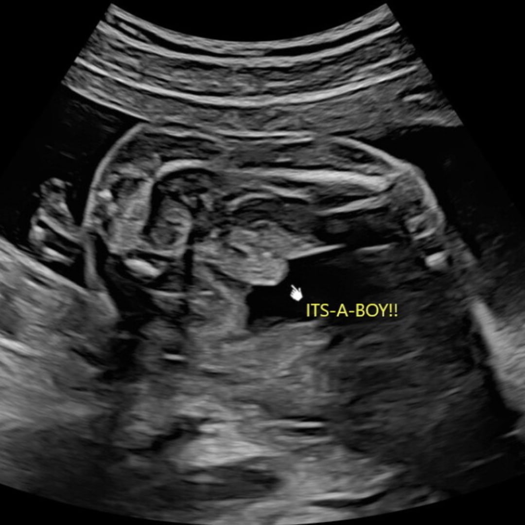 Photo shared by Brianna for their Babylist baby registry.