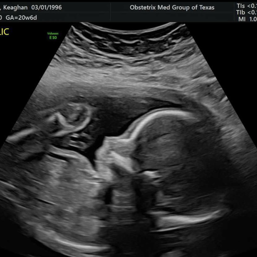 Photo shared by Keaghan for their Babylist baby registry.