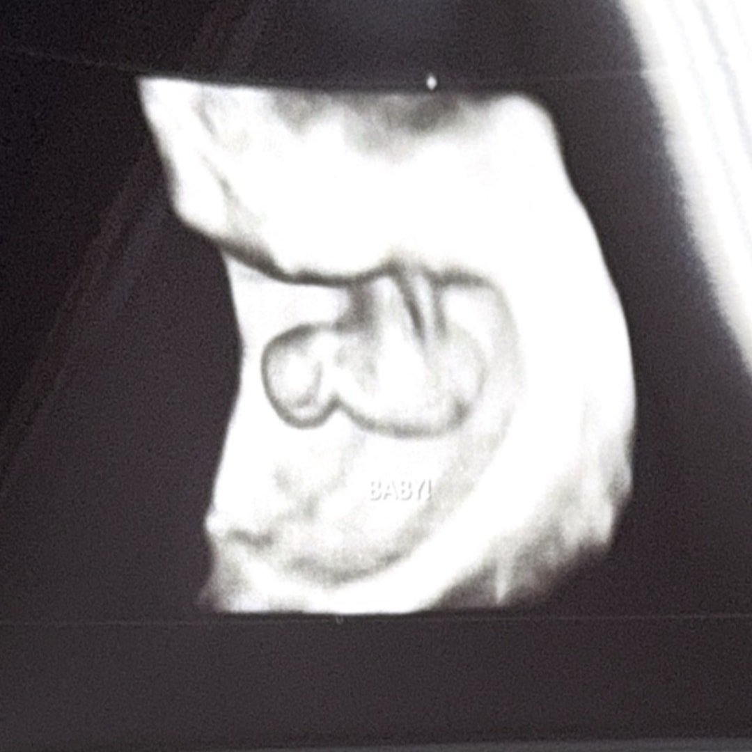Photo shared by Ellyse for their Babylist baby registry.