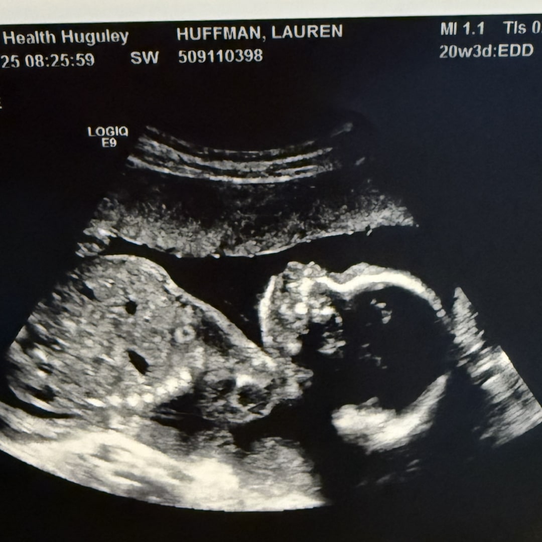 Photo shared by Lauren for their Babylist baby registry.