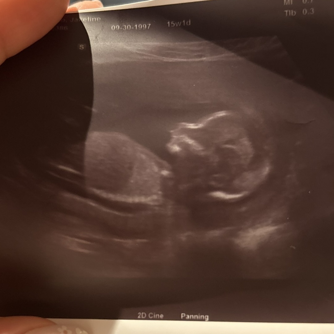 Photo shared by Jackky for their Babylist baby registry.
