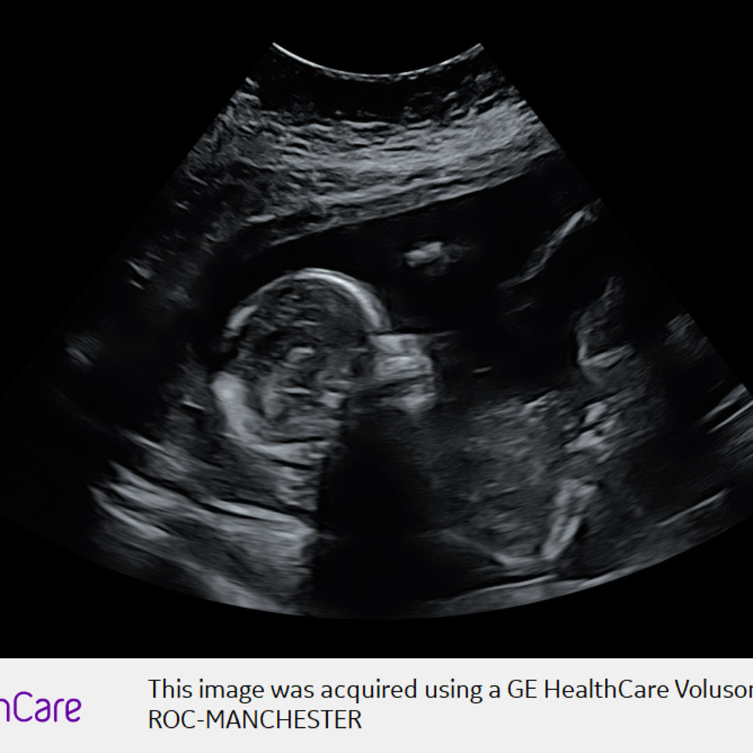 Photo shared by Savannah for their Babylist baby registry.