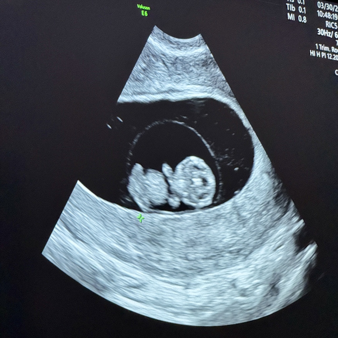 Photo shared by Lindsey for their Babylist baby registry.