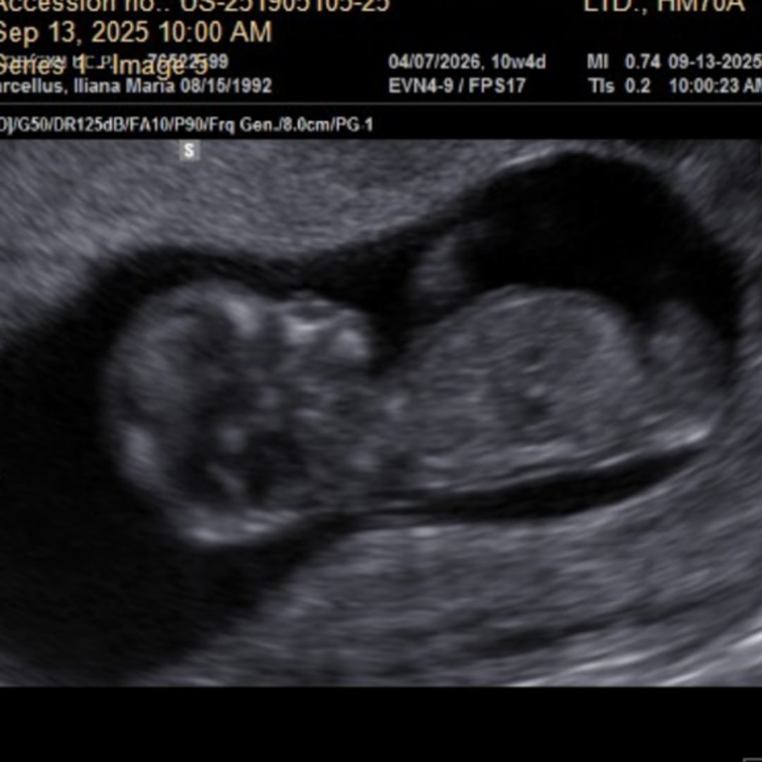 Photo shared by Sam for their Babylist baby registry.