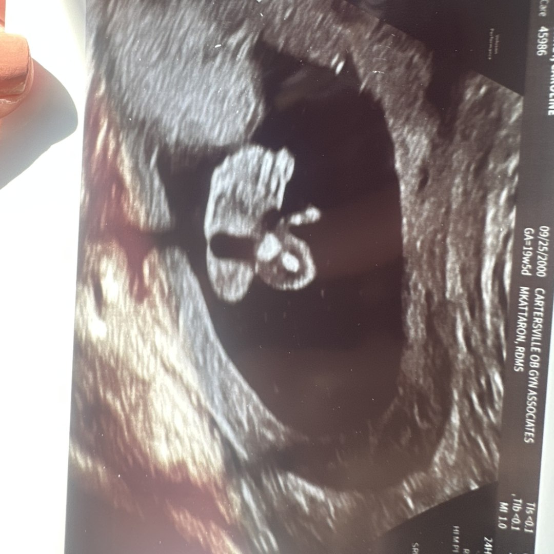 Photo shared by Caroline for their Babylist baby registry.