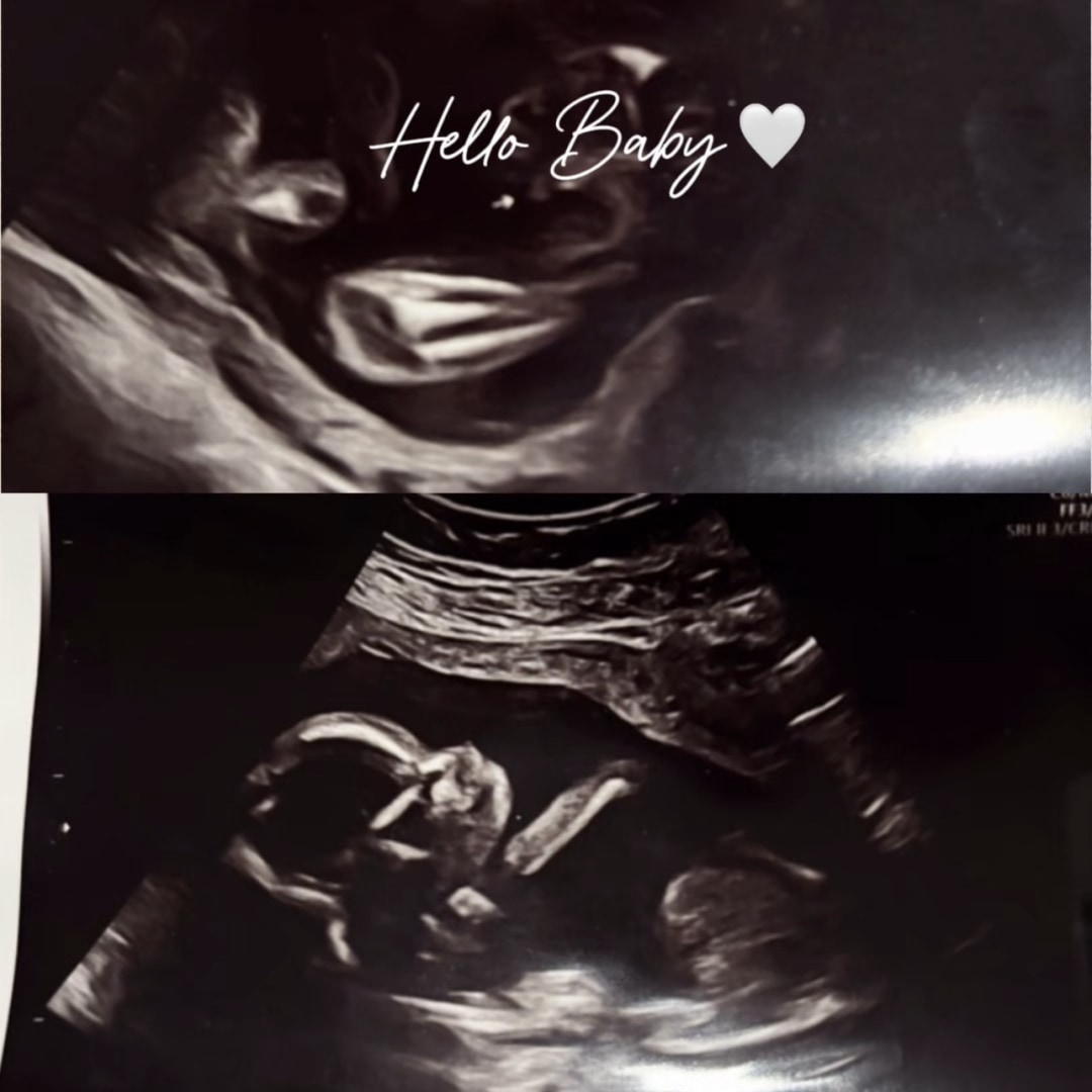 Photo shared by Laniece for their Babylist baby registry.